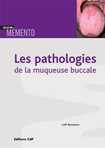 Couverture du livre « Les pathologies de la muqueuse buccale » de Lotfi Benslama aux éditions Cahiers De Protheses