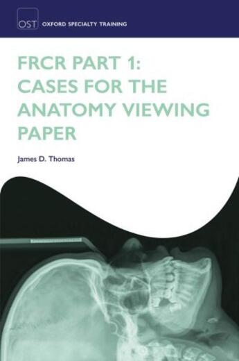 Couverture du livre « FRCR Part 1: Cases for the anatomy viewing paper » de Thomas James D aux éditions Oup Oxford