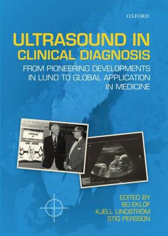 Couverture du livre « Ultrasound in Clinical Diagnosis: From pioneering developments in Lund » de Bo Eklof aux éditions Oup Oxford