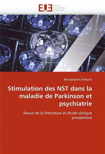 Couverture du livre « Stimulation des nst dans la maladie de parkinson et psychiatrie » de Francois-B aux éditions Editions Universitaires Europeennes