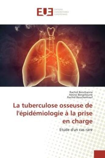 Couverture du livre « La tuberculose osseuse de l'epidemiologie A la prise en charge : Etude d'un cas rare » de Rachid Benjelloune aux éditions Editions Universitaires Europeennes