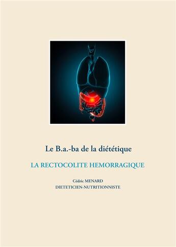 Couverture du livre « Le B.a.-ba de la diététique ; la rectocolite hemorragique » de Cedric Menard aux éditions Books On Demand