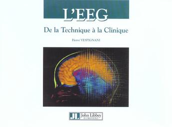 Couverture du livre « L'eeg : de la technique a la clinique » de Herve Vespignani aux éditions John Libbey