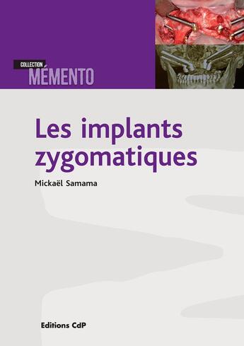 Couverture du livre « Les implants zygomatiques » de Mickaël Samama aux éditions Cahiers De Protheses