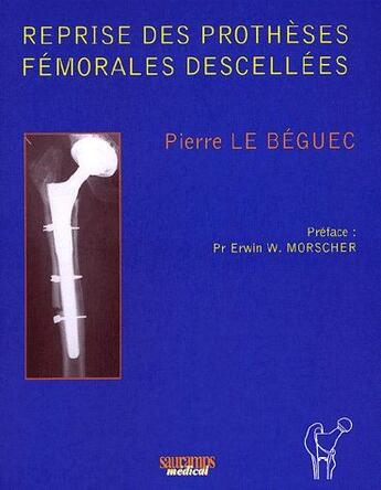 Couverture du livre « Reprises des protheses femorales descellees » de Le Beguec Pierre aux éditions Sauramps Medical