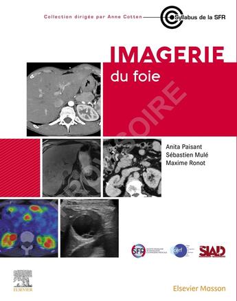 Couverture du livre « Imagerie du foie » de Sebastien Mule et Anita Paisant et Maxime Ronot aux éditions Elsevier-masson