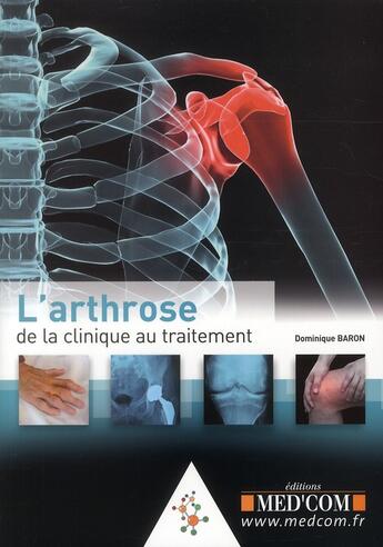 Couverture du livre « L'arthrose : de la clinique au traitement » de Dominique Baron aux éditions Med'com