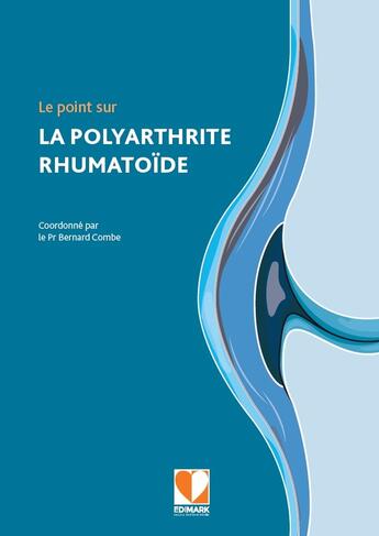 Couverture du livre « Le point sur la polyarthrite rhumatoïde » de Bernard Combe aux éditions Edimark