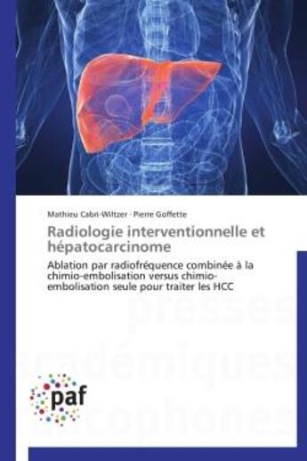 Couverture du livre « Radiologie interventionnelle et hépatocarcinome » de  aux éditions Presses Academiques Francophones