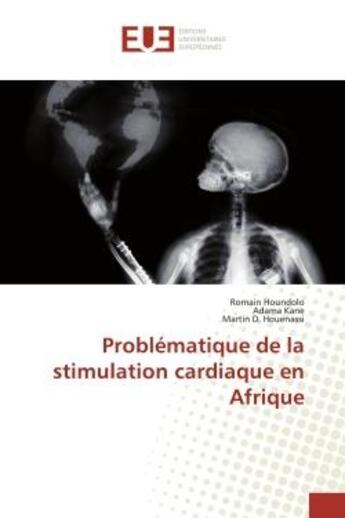 Couverture du livre « Problematique de la stimulation cardiaque en afrique » de Houndolo Romain aux éditions Editions Universitaires Europeennes