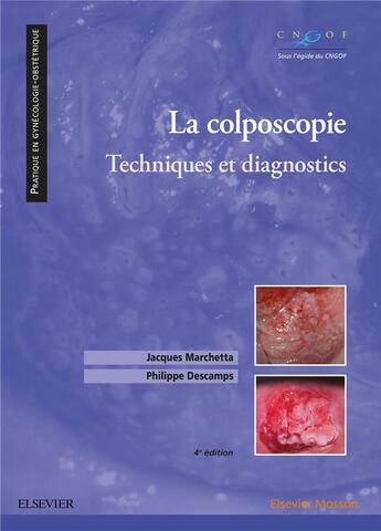 Couverture du livre « La colposcopie » de Philippe Descamps et Jacques Marchetta aux éditions Elsevier-masson