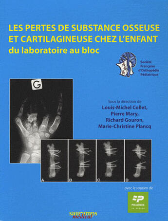 Couverture du livre « Les pertes de substance osseuse et cartilagineuse chez l'enfant du laboratoire au bloc » de Pierre Mary et Marie-Christine Plancq et Louis-Michel Collet et Richard Gouron aux éditions Sauramps Medical