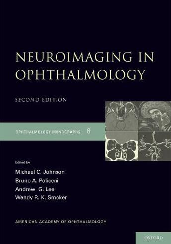 Couverture du livre « Neuroimaging in Ophthalmology » de Smoker Wendy R K aux éditions Oxford University Press Usa