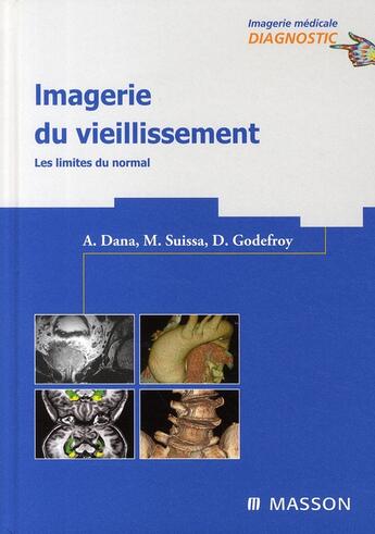 Couverture du livre « Imagerie du vieillissement » de Dana-A aux éditions Elsevier-masson