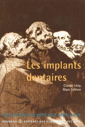 Couverture du livre « Implants dentaires (les) » de Claude Lévy aux éditions Hermann