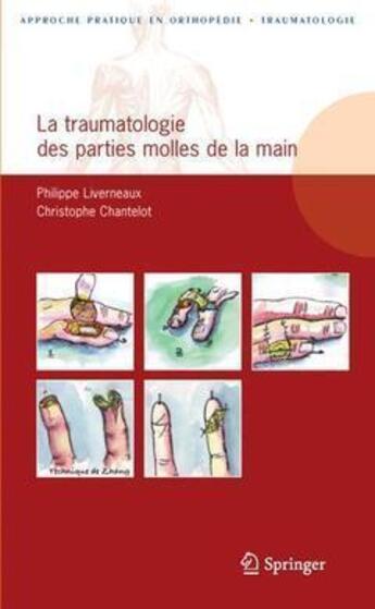 Couverture du livre « La traumatologie des parties molles de la main » de Philippe Liverneaux et Christophe Chantelot aux éditions Springer