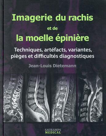 Couverture du livre « Imagerie du rachis et de la moelle épinière ; techniques, artefacts, variantes, pièges et difficultés diagnostiques » de Jean-Louis Dietemann aux éditions Sauramps Medical