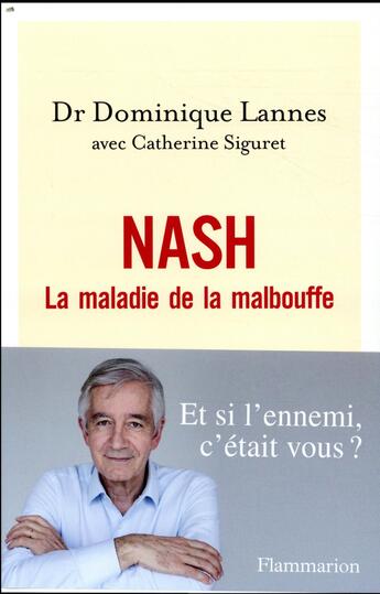 Couverture du livre « NASH ; la maladie de la malbouffe » de Dominique Lannes et Catherine Siguret aux éditions Flammarion