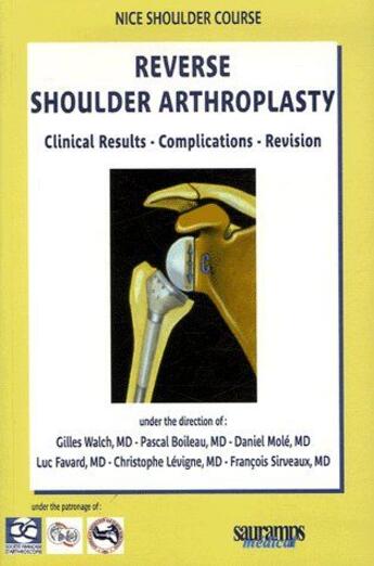 Couverture du livre « Reserve shoulder arthroplasty ; clinical results, complications, revision » de  aux éditions Sauramps Medical