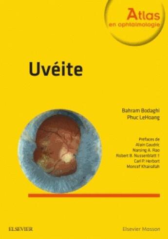 Couverture du livre « Uvéites (2e édition) » de Bahram Bodaghi et Phuc Lehoang aux éditions Elsevier-masson