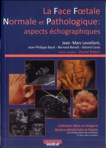 Couverture du livre « La face foetale normale et pathologique: aspects échographiques » de Gerard Couly et Bault Jean-Philippe et Jean-Marc Levaillant et Benoit Bernard aux éditions Sauramps Medical