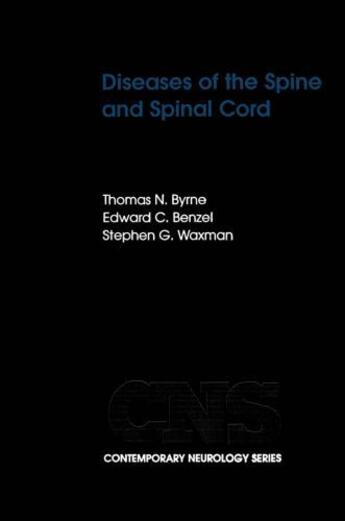 Couverture du livre « Diseases of the Spine and Spinal Cord » de Waxman Stephen G aux éditions Oxford University Press Usa