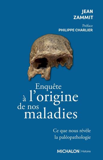 Couverture du livre « Enquête à l'origine de nos maladies : Ce que nous révèle la paléopathologie » de Jean Zammit aux éditions Michalon