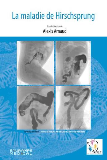 Couverture du livre « La maladie de Hirschsprung » de Collectif et Alexis Arnaud aux éditions Sauramps Medical