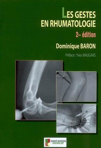 Couverture du livre « Les gestes en rhumatologie » de Dominique Baron aux éditions Sauramps Medical