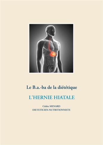 Couverture du livre « Le B.a.-ba diététique de l'hernie hiatale » de Cedric Menard aux éditions Books On Demand