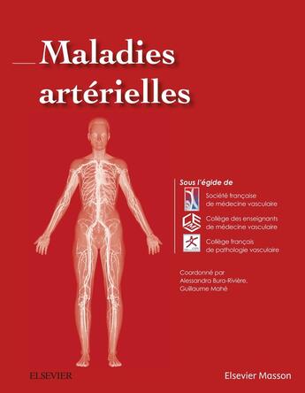 Couverture du livre « Maladies artérielles » de  aux éditions Elsevier-masson