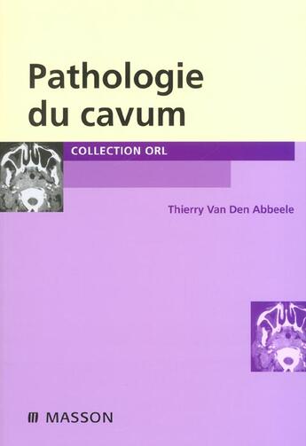 Couverture du livre « Pathologie du cavum » de Thierry Van Den Abbeele aux éditions Elsevier-masson