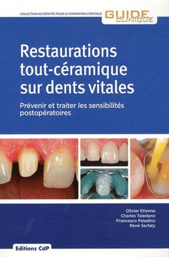 Couverture du livre « Restauration tout céramique sur dent vitale » de Etienne Toledan aux éditions Cahiers De Protheses