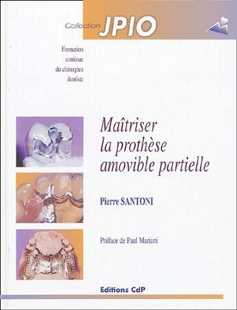 Couverture du livre « Maîtriser la prothèse amovible partielle » de  aux éditions Cahiers De Protheses