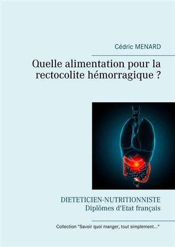 Couverture du livre « Quelle alimentation pour la rectocolite hémorragique? » de Cedric Menard aux éditions Books On Demand