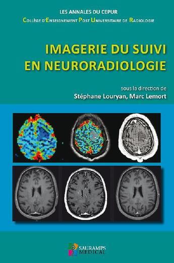 Couverture du livre « Imagerie du suivi en neuroradiologie » de Stephane Louryan et Marc Lemort aux éditions Sauramps Medical