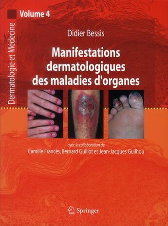 Couverture du livre « Manifestations dermatologiques des maladies d'organe Tome 4 » de Didier Bessis aux éditions Springer