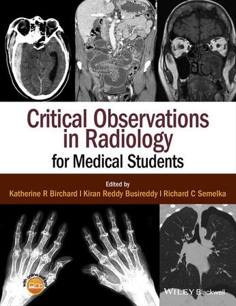 Couverture du livre « Critical Observations in Radiology for Medical Students » de Richard C. Semelka et Katherine R. Birchard et Kiran Reddy Busireddy aux éditions Wiley-blackwell