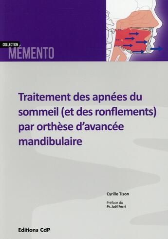 Couverture du livre « Traîtement des apnées du sommeil et des ronflements par orthèse avancée » de Cyrille Tison aux éditions Cahiers De Protheses