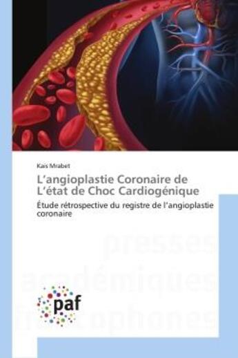 Couverture du livre « L'angioplastie coronaire de l'etat de choc cardiogenique - etude retrospective du registre de l'angi » de Mrabet Kais aux éditions Editions Universitaires Europeennes