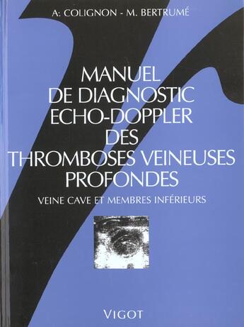 Couverture du livre « Manuel de diagnostic echo doppler des thromboses veineuses p » de Jean-Pierre Colignon aux éditions Vigot