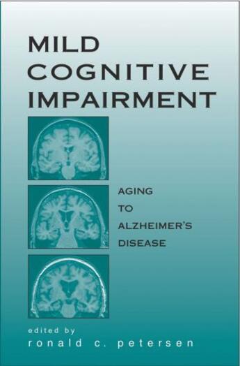 Couverture du livre « Mild Cognitive Impairment: Aging to Alzheimer's Disease » de Ronald C Petersen aux éditions Oxford University Press Usa