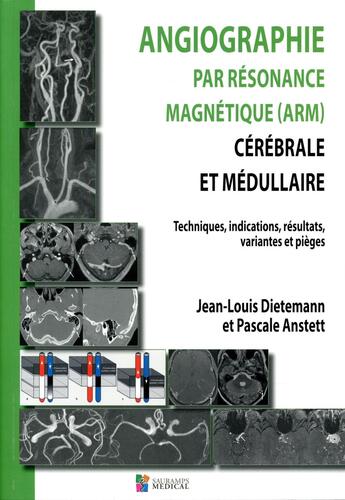 Couverture du livre « Angiographie par résonance magnétique (arm) cérébrale et médullaire ; technique, indications, résultats, variantes et pièges » de Jean-Louis Dietemann et Pascale Anstett aux éditions Sauramps Medical