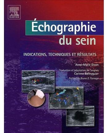 Couverture du livre « Échographie du sein ; indications, techniques et résultats » de Anne-Marie Dixon aux éditions Elsevier-masson