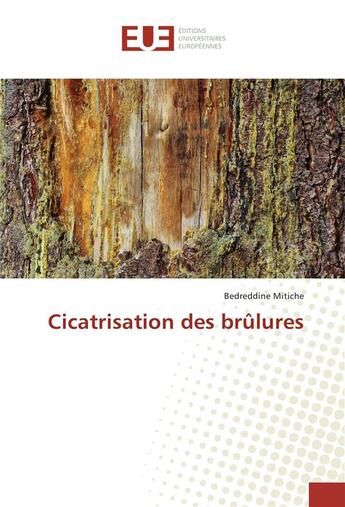 Couverture du livre « Cicatrisation des brulures » de Mitiche Bedreddine aux éditions Editions Universitaires Europeennes