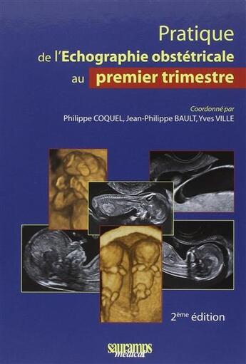 Couverture du livre « Pratique de l'échographie obstétricale ; trois trimestres » de Philippe Coquel et Bault Jean-Philippe et Yves Ville aux éditions Sauramps Medical