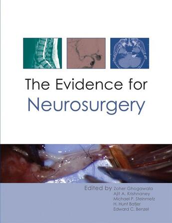 Couverture du livre « The Evidence for Neurosurgery » de Zoher Ghogawala, Ajit Krishnaney, Michael Steinmetz, H Batjer aux éditions Tfm Publishing Ltd