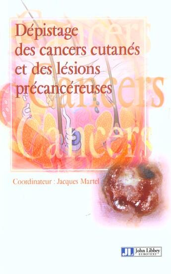 Couverture du livre « Depistage cancers cutanes lesions precancer » de Martel aux éditions John Libbey