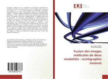 Couverture du livre « Fusion des images medicales de deux modalites : scintigraphie osseuse » de Ben Sellem Dorra aux éditions Editions Universitaires Europeennes