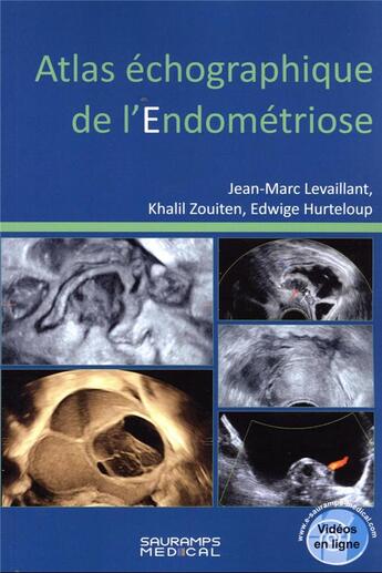 Couverture du livre « Atlas échographique de l'endométriose » de Jean-Marc Levaillant et Khalil Zouiten et Edwige Hurteloup aux éditions Sauramps Medical